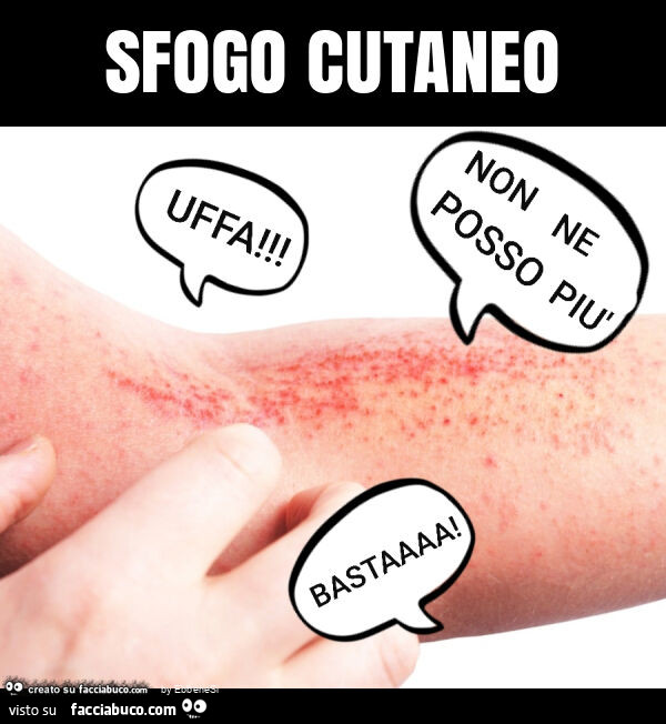Sfogo cutaneo