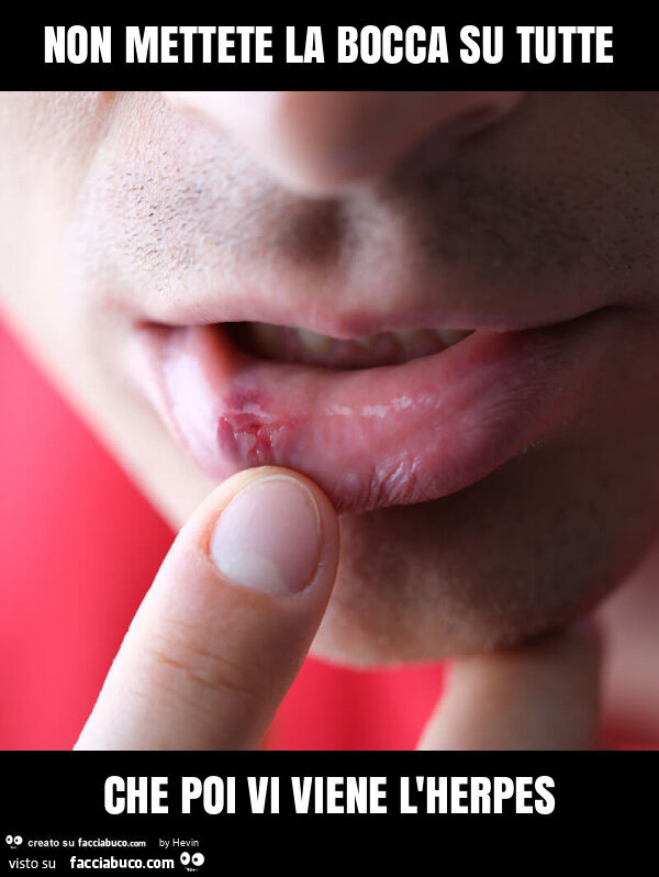 Non mettete la bocca su tutte che poi vi viene l'herpes