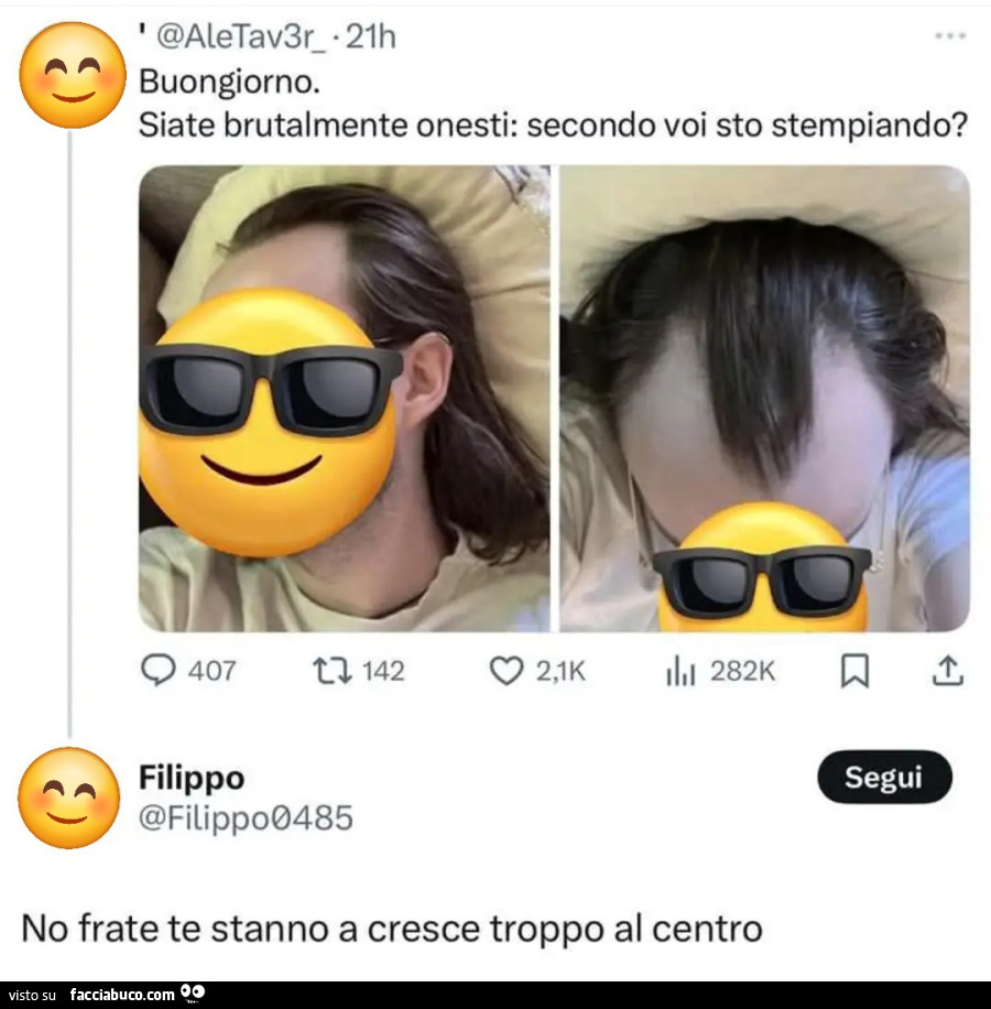 Buongiorno siate brutalmente onesti secondo voi sto stempiando no frate te stanno a cresce troppo al centro