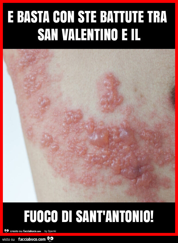 E basta con ste battute tra san valentino e il fuoco di sant'antonio