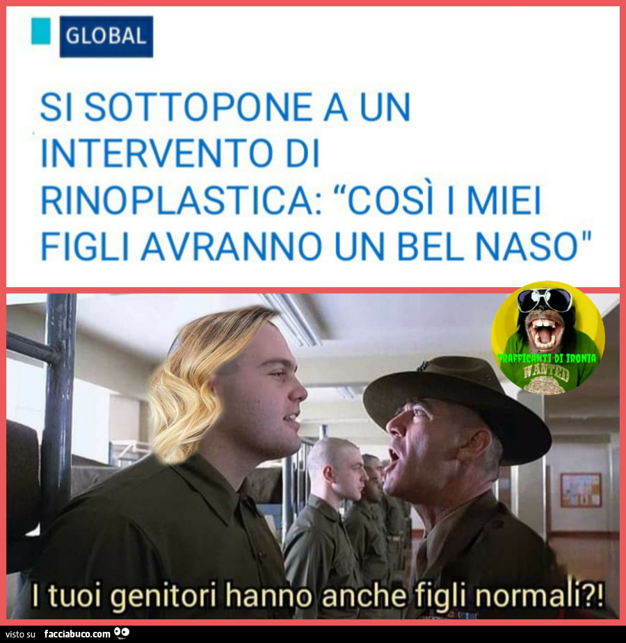 Si sottopone a un intervento di rinoplastica così i miei figli avranno un bel naso