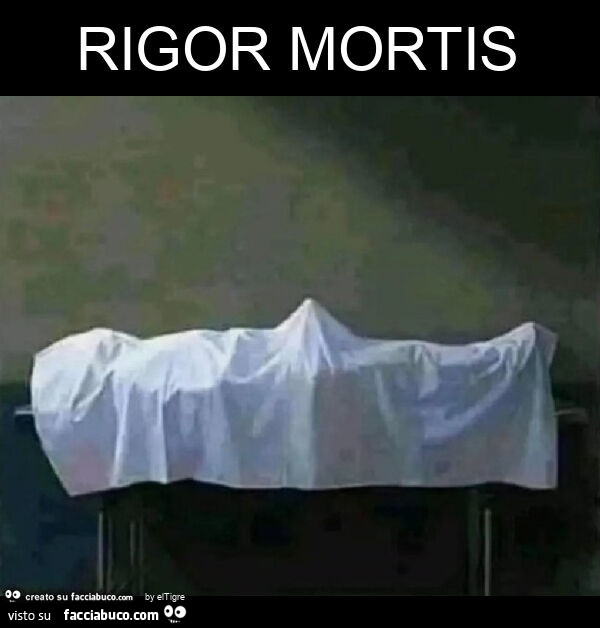 Rigor mortis