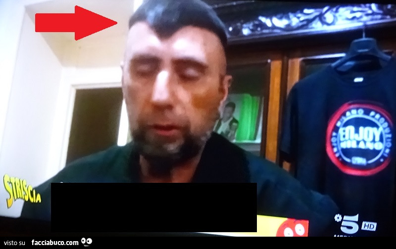 Barbyturiko, Vlad